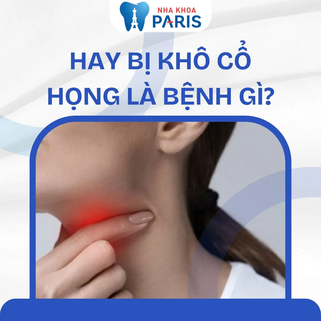 Hay bị khô cổ họng là bệnh gì? Nguyên nhân và cách điều trị
