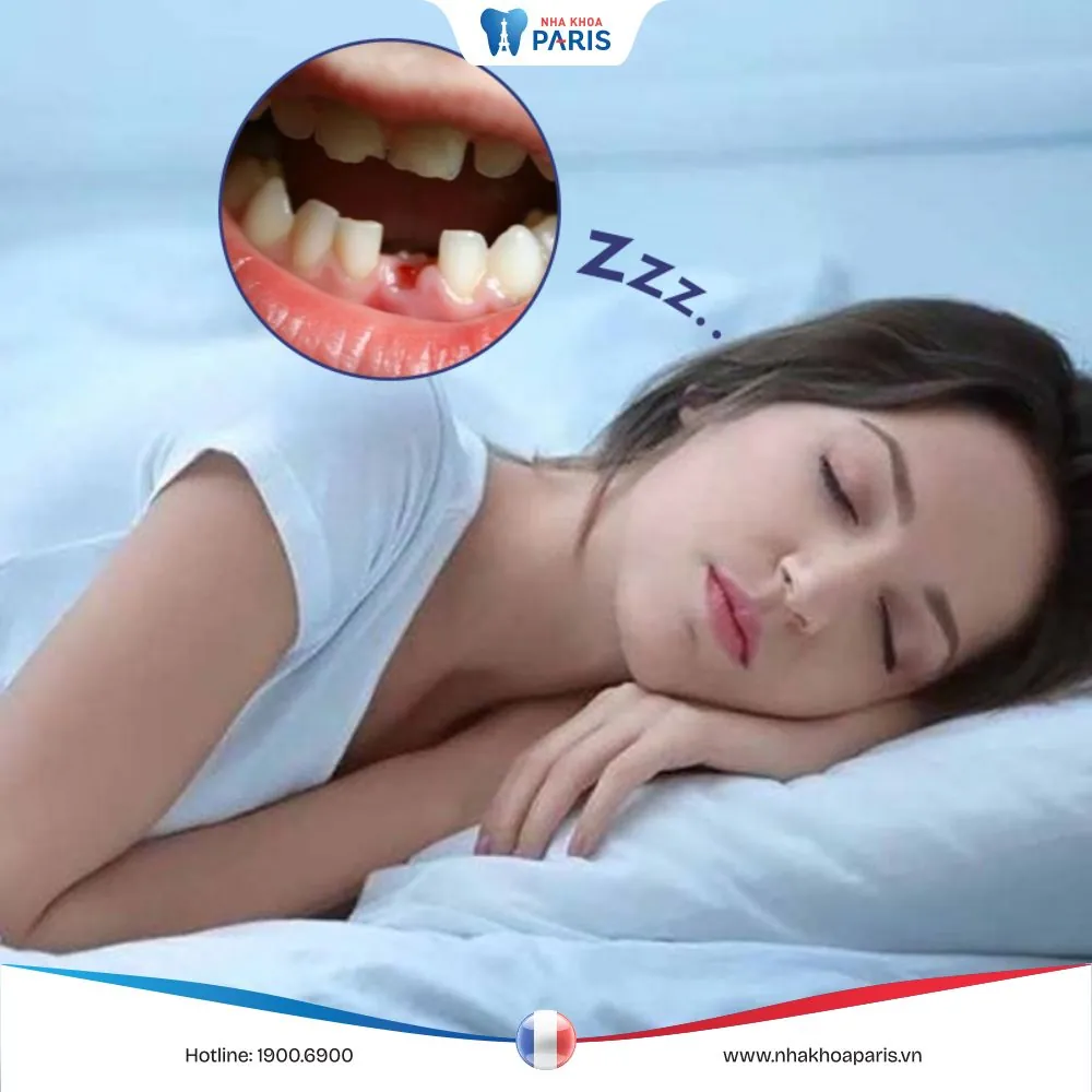 Nằm mơ thấy rụng nhiều răng có điềm báo gì? Giải mã các giấc mơ