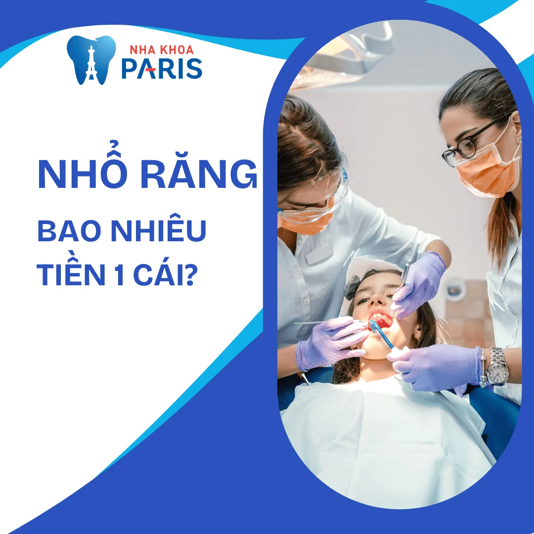 Nhổ răng bao nhiêu tiền 1 cái? Cập nhật bảng giá 2025