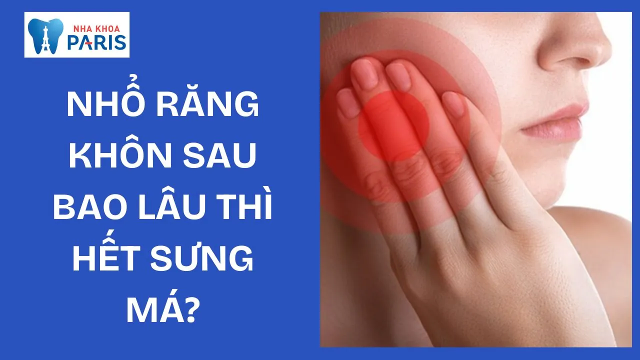 Nhổ răng khôn sau bao lâu thì hết sưng má? Cách giảm sưng hiệu quả