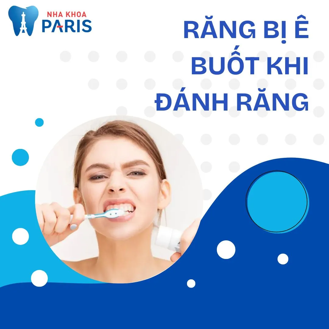 Răng bị ê buốt khi đánh răng là do đâu? Phương pháp điều trị