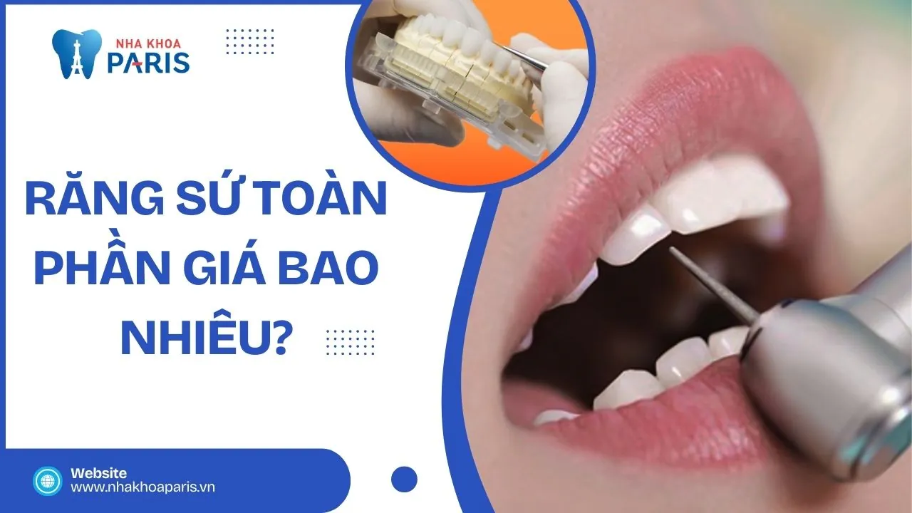 Bọc răng sứ toàn phần giá bao nhiêu? Tìm hiểu ngay!