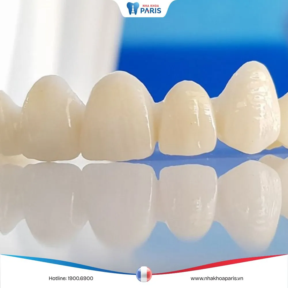 Răng toàn sứ loại nào tốt nhất ? Ưu nhược điểm của từng loại