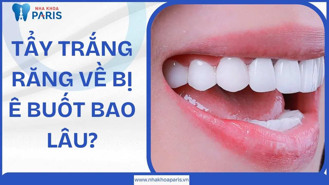 Tẩy trắng răng về bị ê buốt bao lâu? 6 cách giảm ê buốt hiệu quả