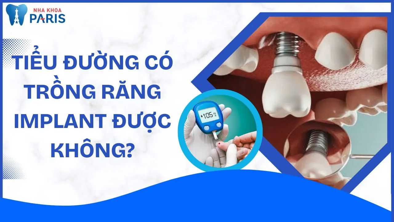 Tiểu đường có trồng răng Implant được không? Cần lưu ý gì?
