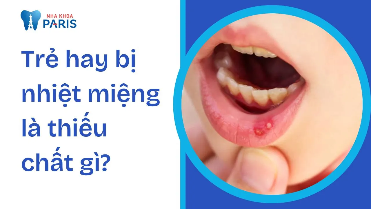 Trẻ hay bị nhiệt miệng là thiếu chất gì? Bác sĩ giải đáp