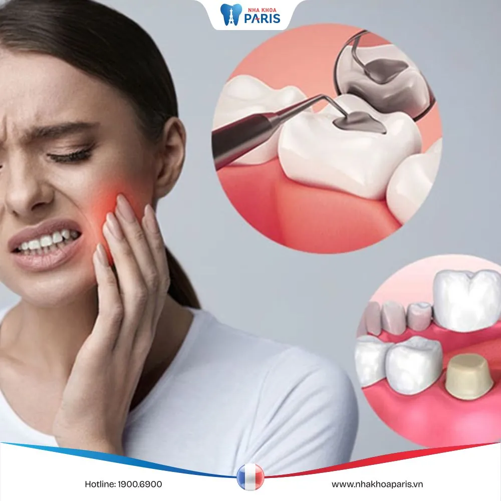 Cách trị nhức răng có lỗ an toàn | Hiệu quả nhanh tại nhà