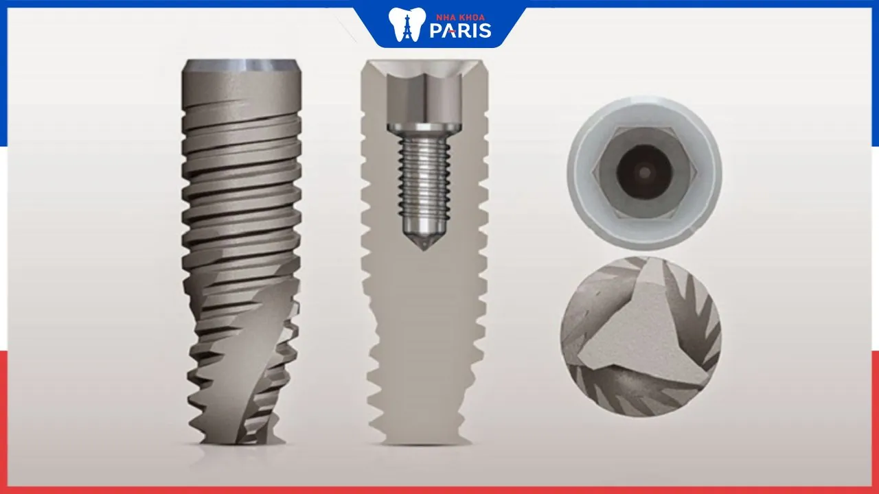 Trụ Implant Hiossen: Khái niệm, cấu tạo và ưu nhược điểm