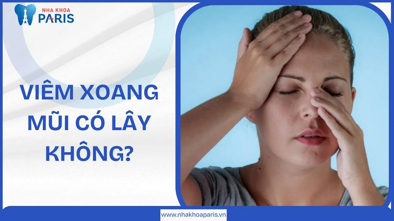 Viêm xoang mũi có lây không? Những điều bạn cần biết
