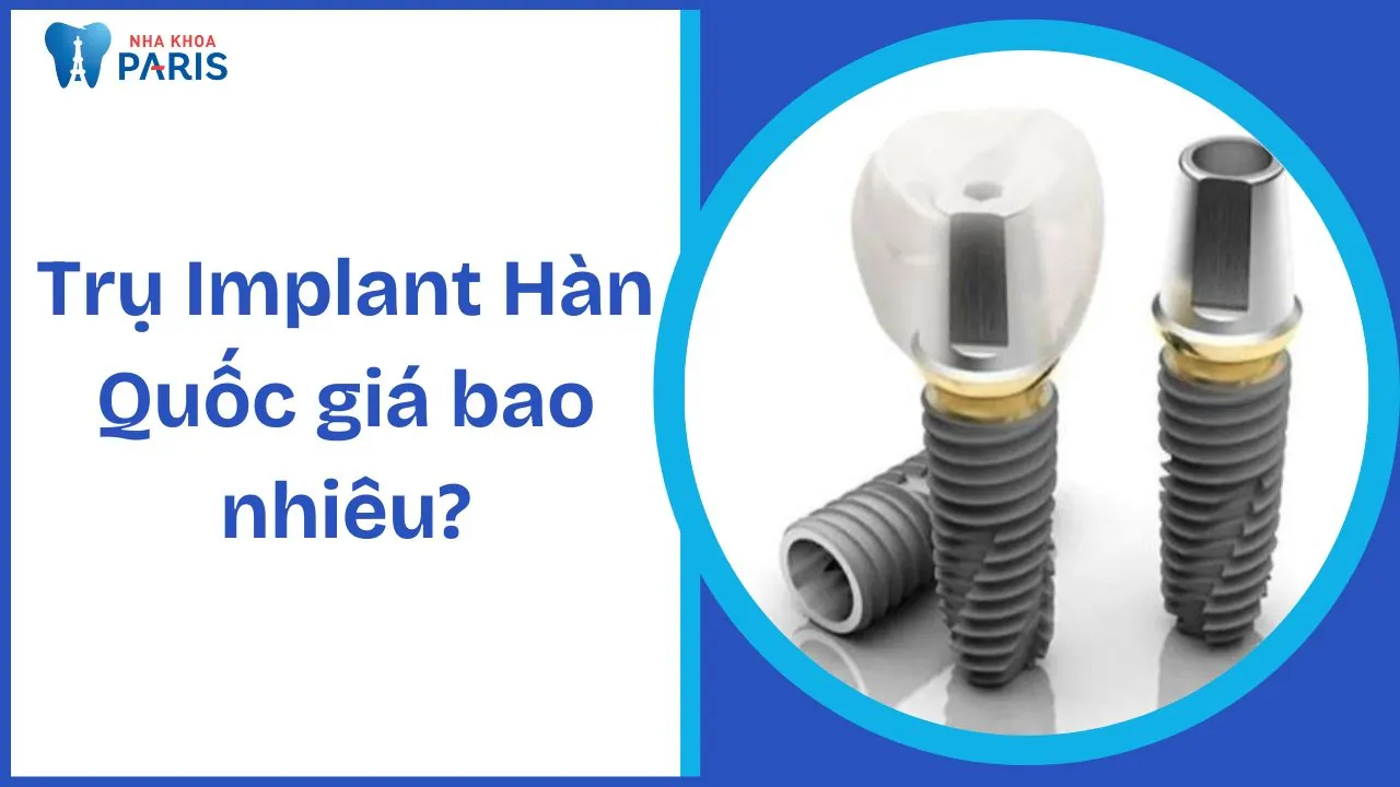 Trụ Implant Hàn Quốc giá bao nhiêu? Cập nhật bảng giá và chất lượng 2025
