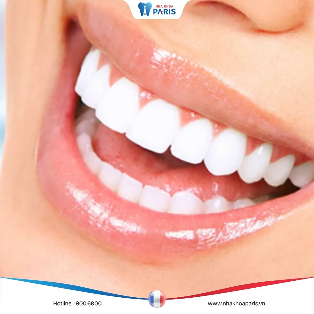 Bọc răng sứ ở đâu tốt nhất? Tiêu chí lựa chọn nha khoa uy tín