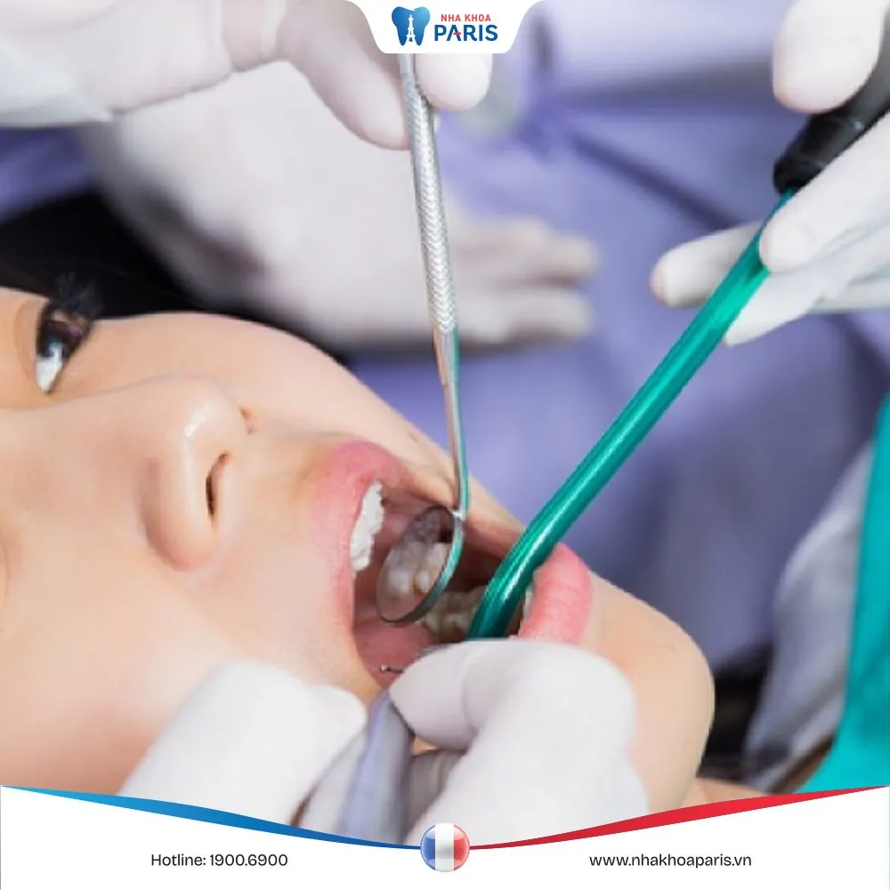 Nhổ răng số 8 có đau không? Một số lưu ý giúp vết thương nhanh lành