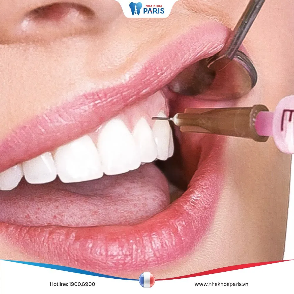 Tác dụng phụ của thuốc gây tê khi nhổ răng – Bác sĩ nha khoa Đàm Ngọc Trâm
