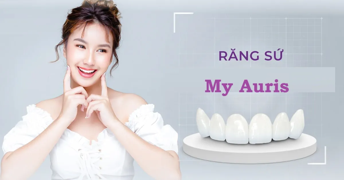 Răng sứ My Auris là gì? có ưu điểm gì nổi bật