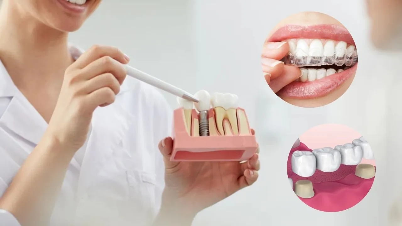 Trồng răng giá rẻ có những phương pháp nào? có tốt không?