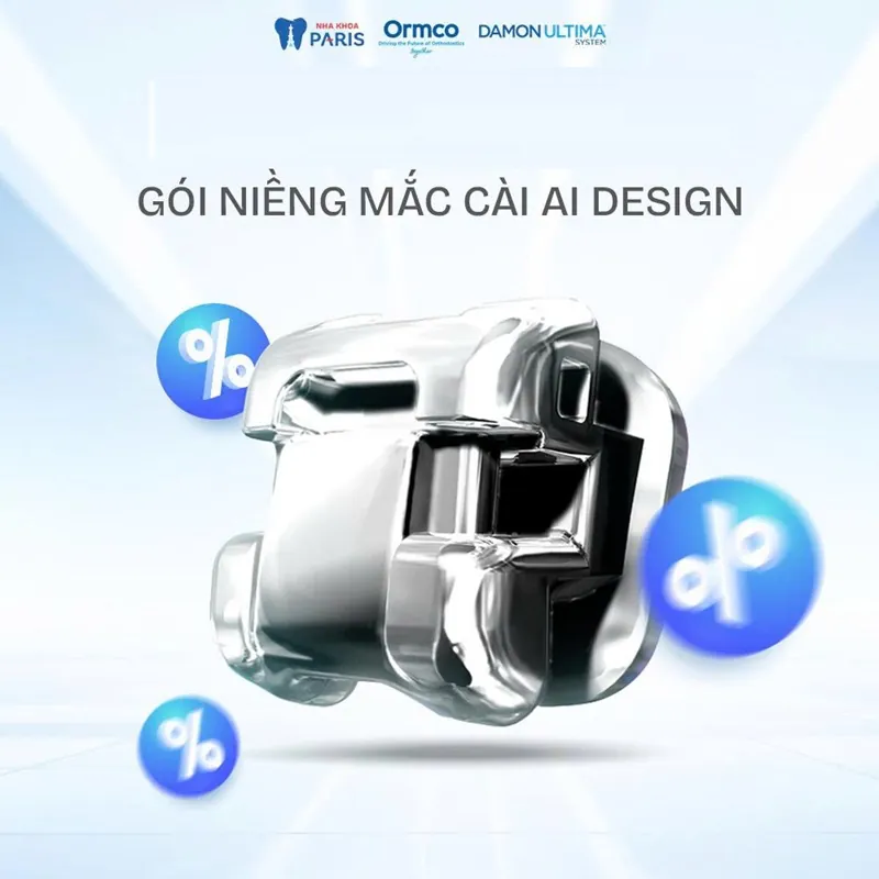 Niềng răng với mắc cài tự buộc AI Design (Damon) có tốt không?