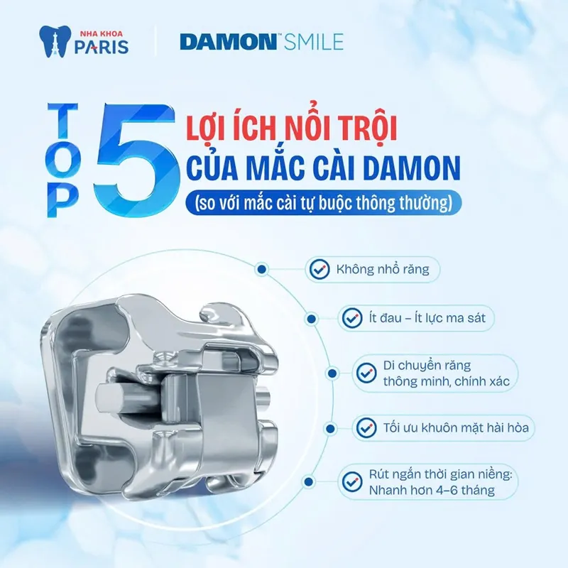 So sánh mắc cài tự buộc AI Design (Damon) với mắc cài truyền thống 